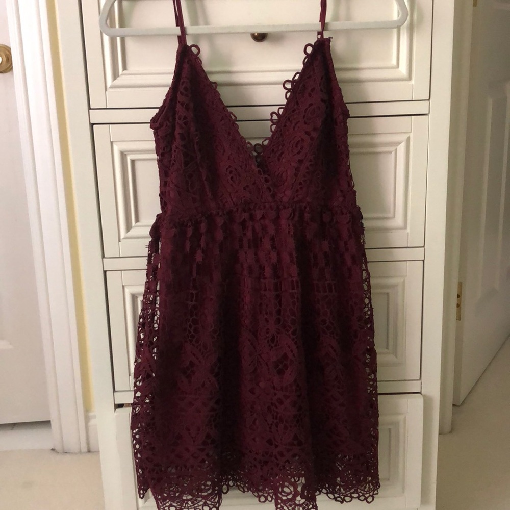tobi summer lace dress